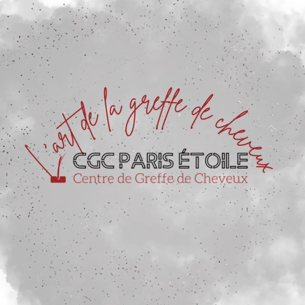 Avis-Centre-de-greffe-de-cheveux-Paris-etoile
