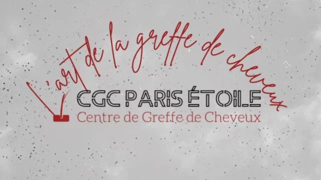 Avis-Centre-de-greffe-de-cheveux-Paris-etoile