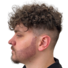 Greffe-capillaire-cheveux-boucles-technique-choi