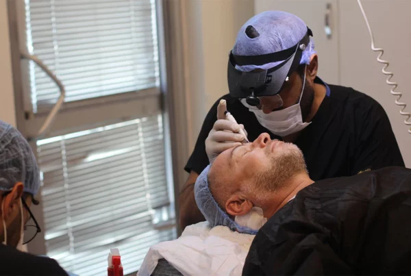 Greffe-de-cheveux--Choi-ideale-ligne-frontale