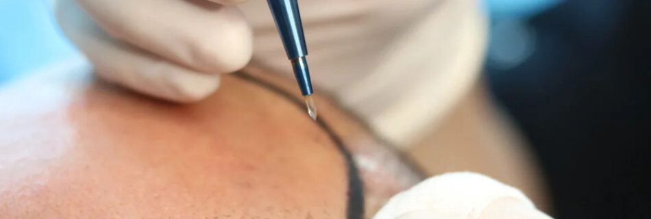 Choisir-chirurgien-CHOI