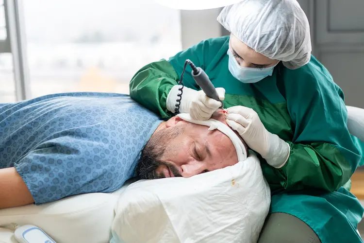 Douleur greffe de cheveux : Vrai ou faux ?