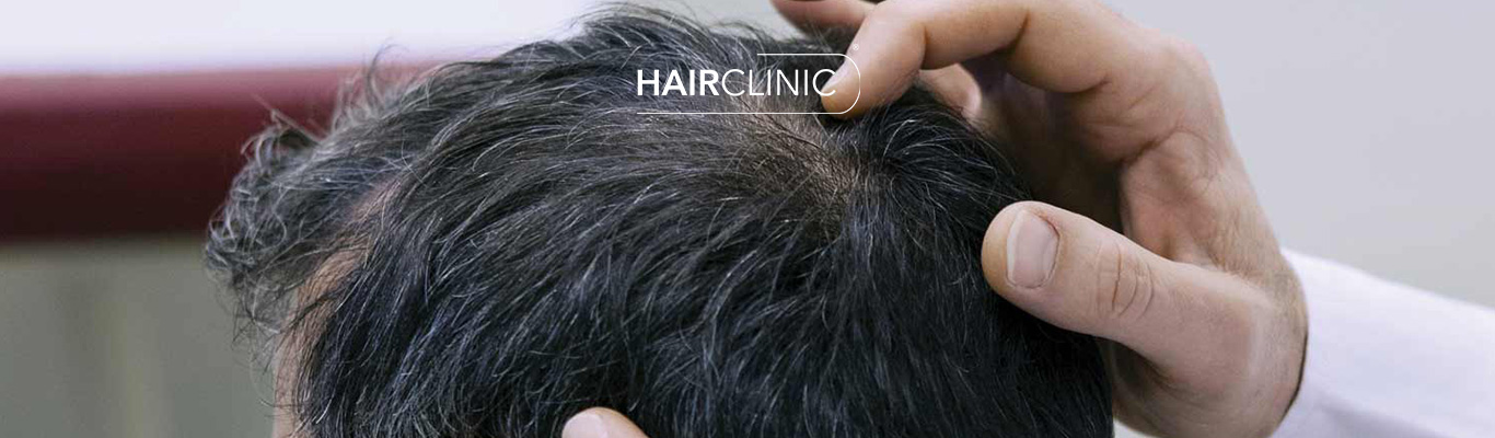 Avis Hair Clinic Marseille greffe de cheveux