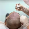 Incision-cicatrice-visible-technique-CHOI