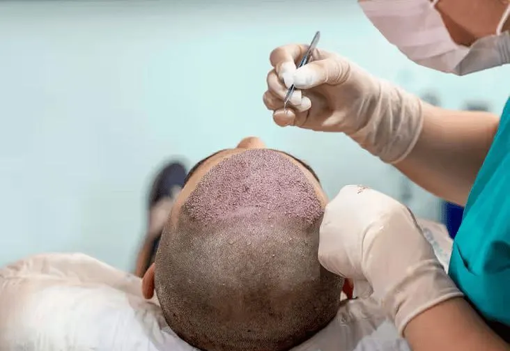 Aucune incision ou cicatrice visible : le point fort de la méthode CHOI