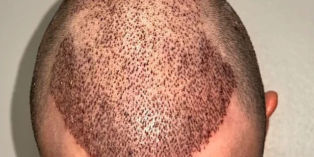 Idees-reçues-technique-Choi