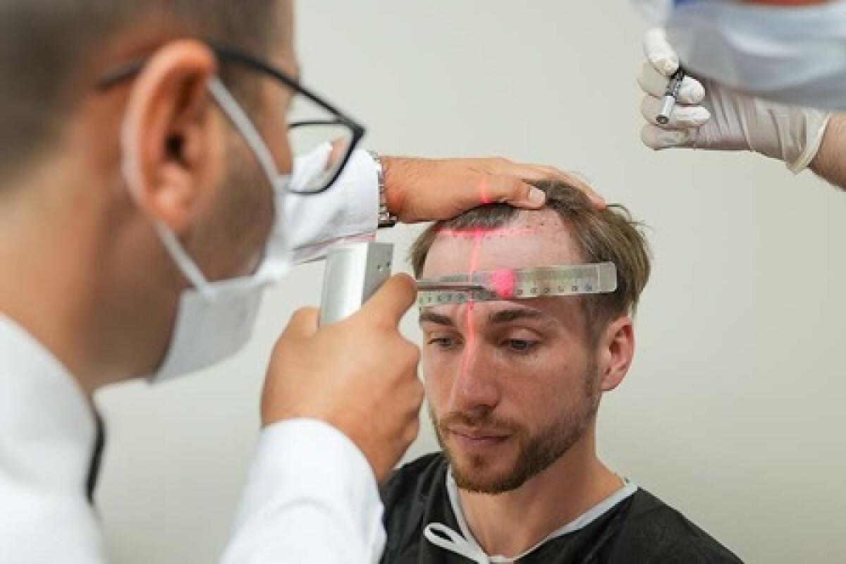 Pourquoi choisir l'Espagne pour une greffe de cheveux