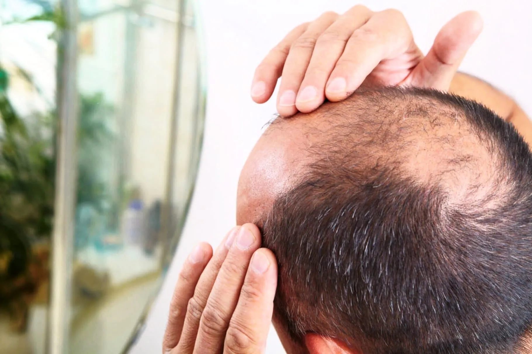 Compléments alimentaires et soins anti-chute de cheveux