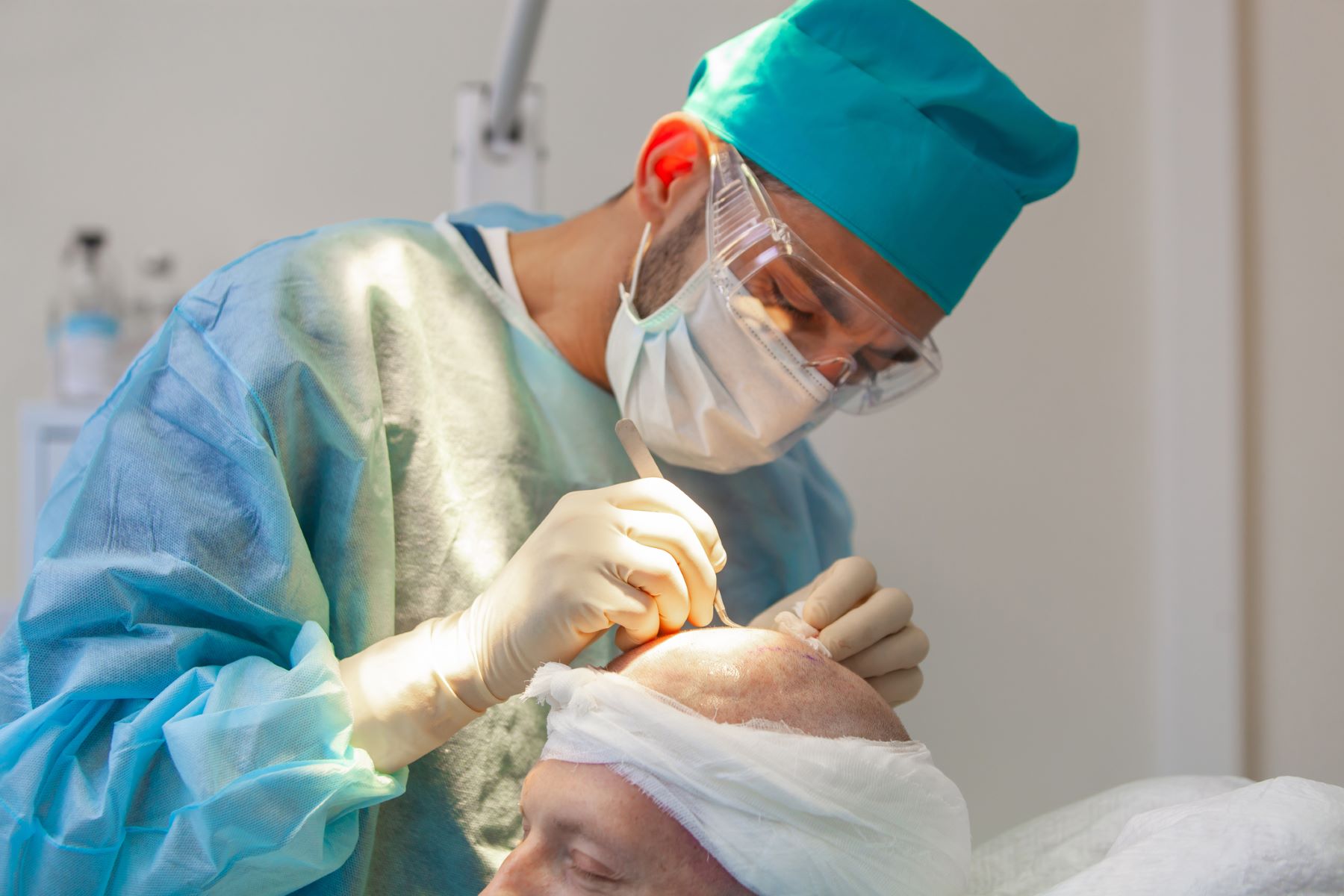 Implantation de greffons folliculaires lors d'une greffe de cheveux