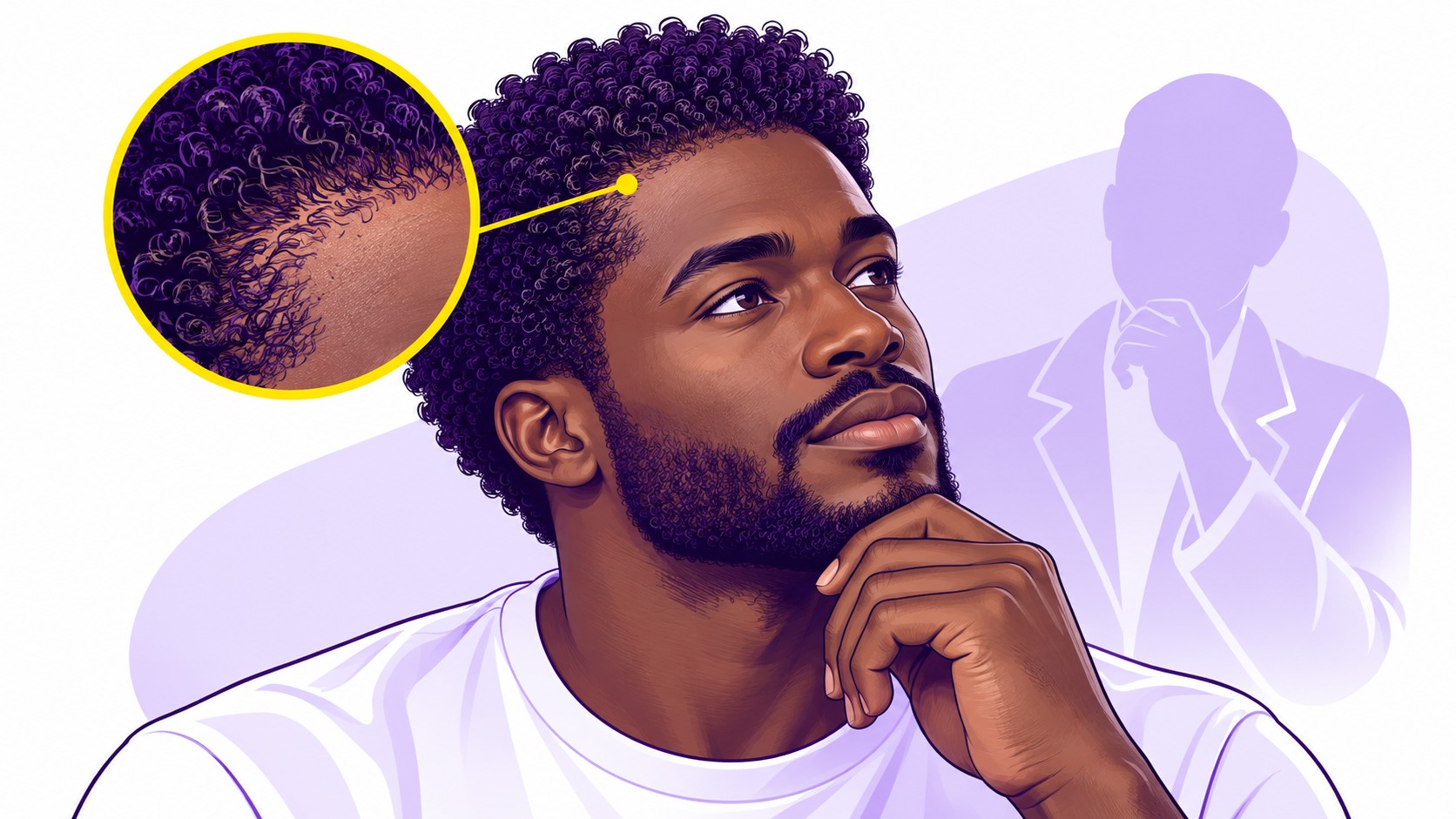 illustration éditoriale homme noir cheveux afro crépus courts, vue trois quarts, main sous le menton, gros plan circulaire sur ligne frontale et implantation des cheveux bouclés, repère jaune reliant la zone observée au cuir chevelu, silhouette violette de praticien en arrière-plan, fond blanc et violet